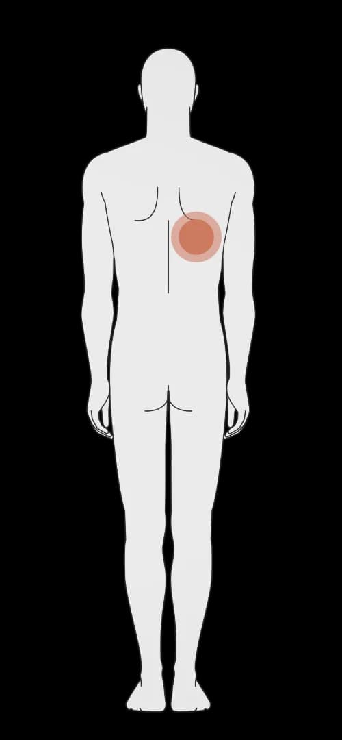 Pliegue subescapular